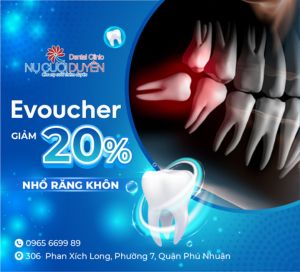 Nu Cuoi Duyen Voucher