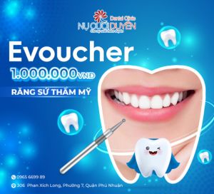 Nu Cuoi Duyen Voucher
